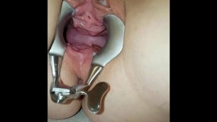 Vibrating Anal Beads, Speculum, Vibrator Playtime